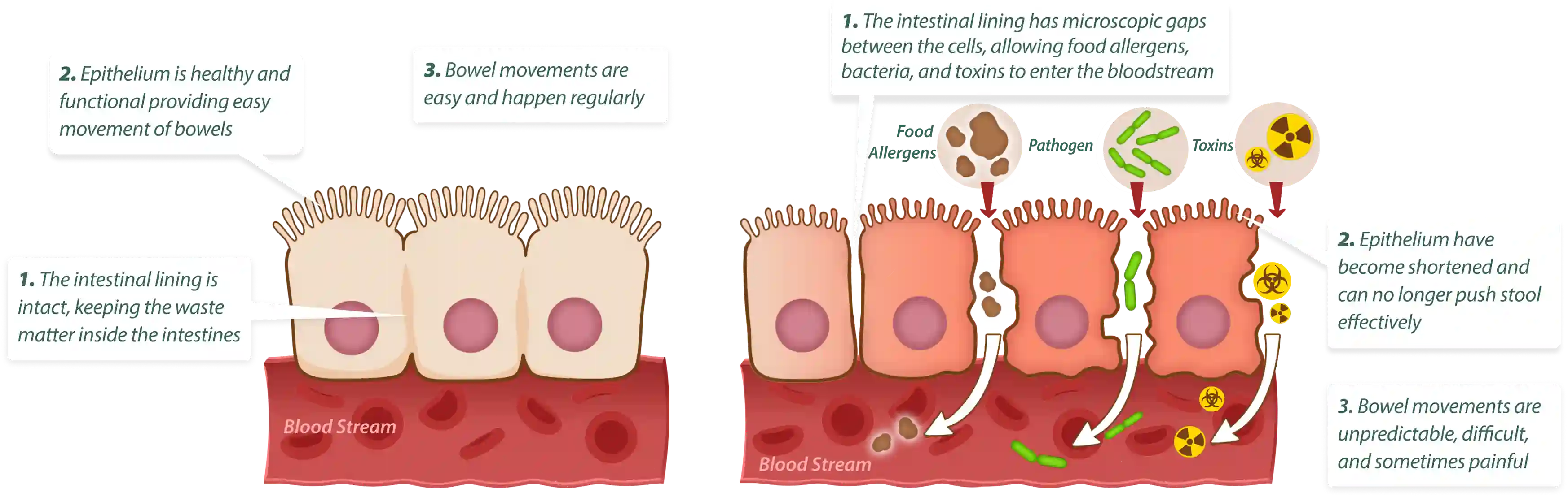 How EmmaRelef works – 3-step gut cleansing and healing process
