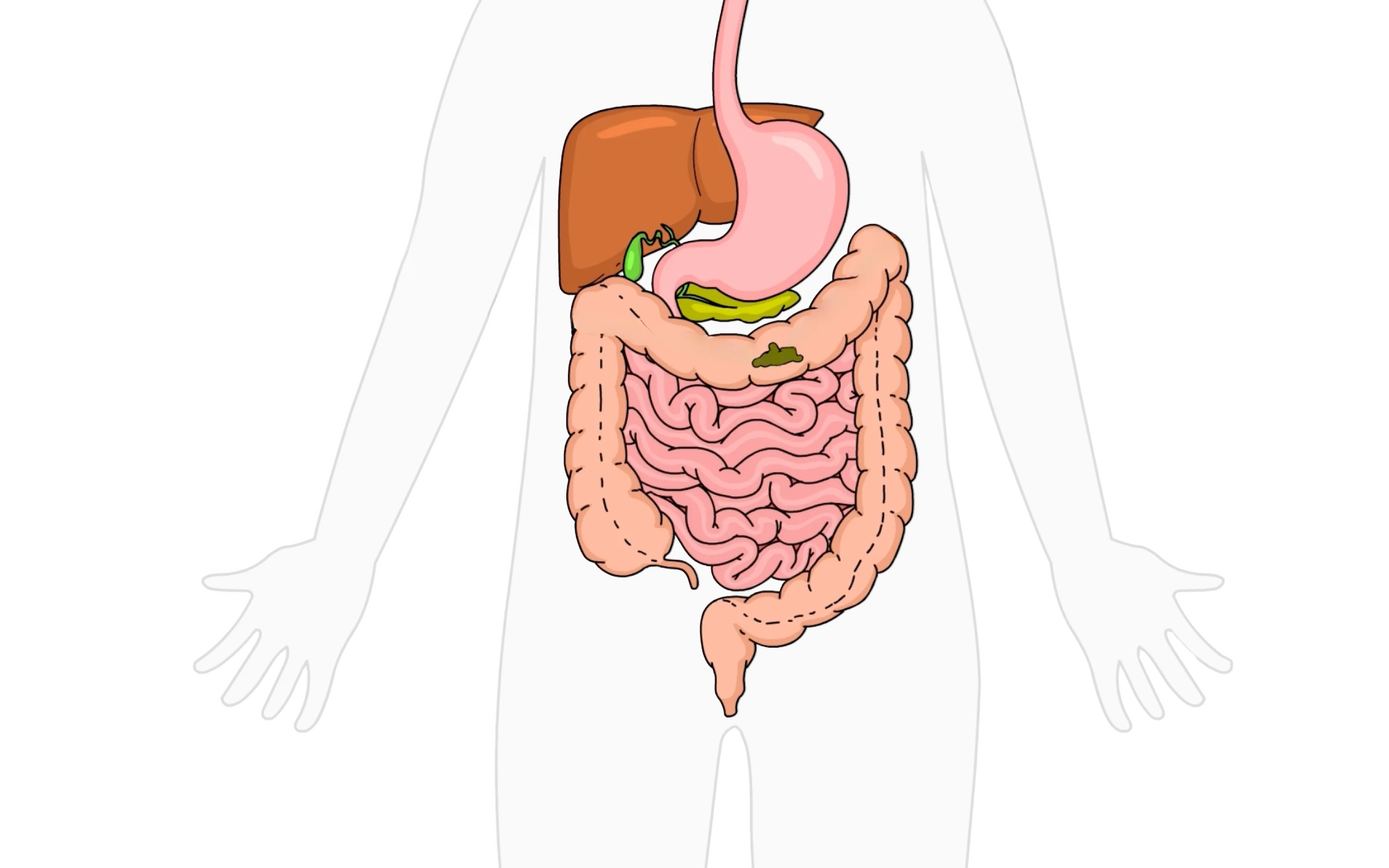 EmmaRelef gut health video illustration