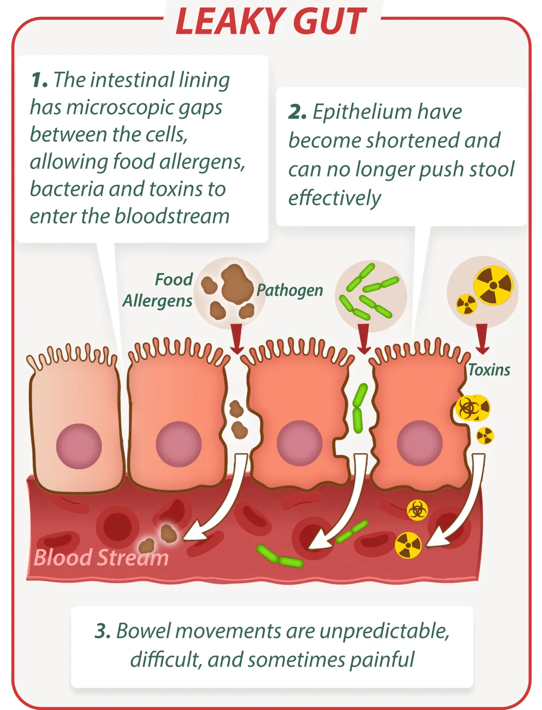 Leaky gut without EmmaRelef – digestive issues illustration